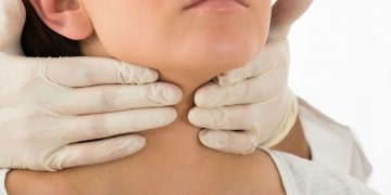 come.curare.malattia-hashimoto