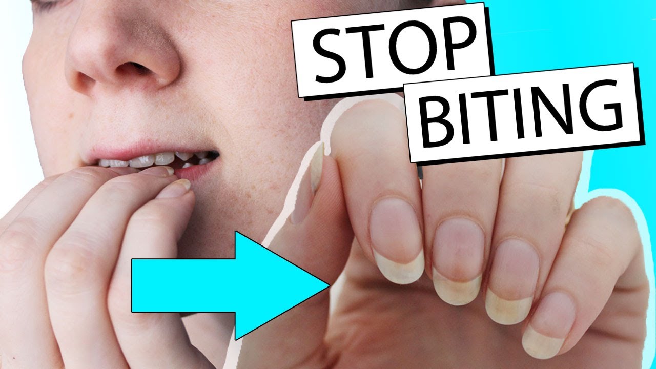 How to stop biting your nails