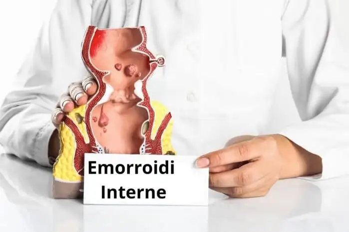 emorroidi farmaci