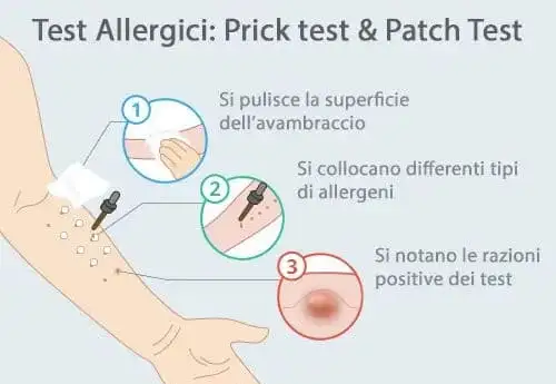 allergie prove