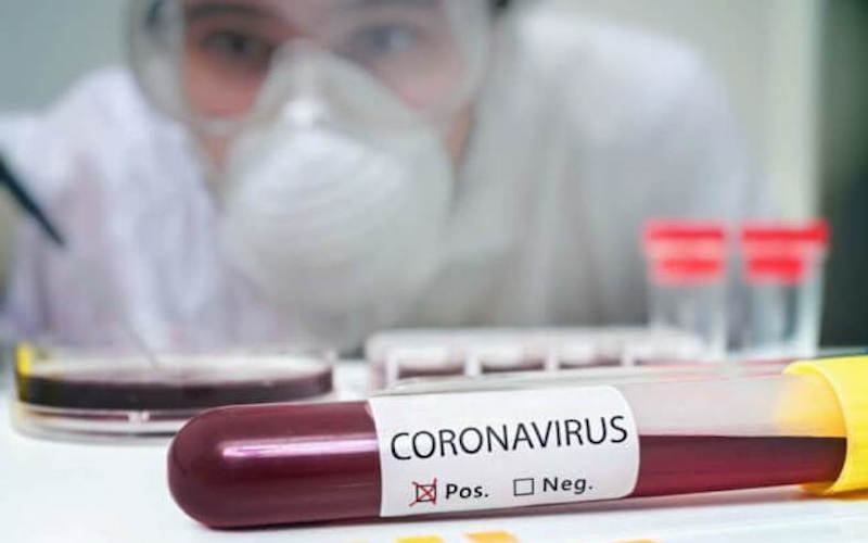 Test per Coronavirus