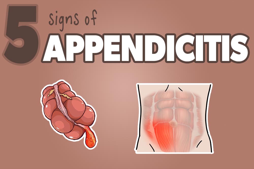 rimedi medici per curare l'appendicite